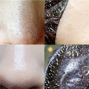 shein 15 Pcs Blackhead Nose Strips